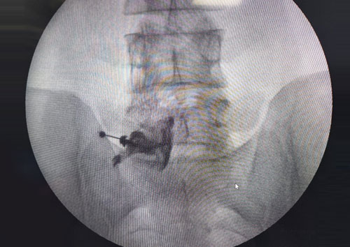 Advanced Pain Management Techniques