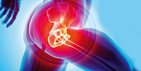 Total Hip Replacement