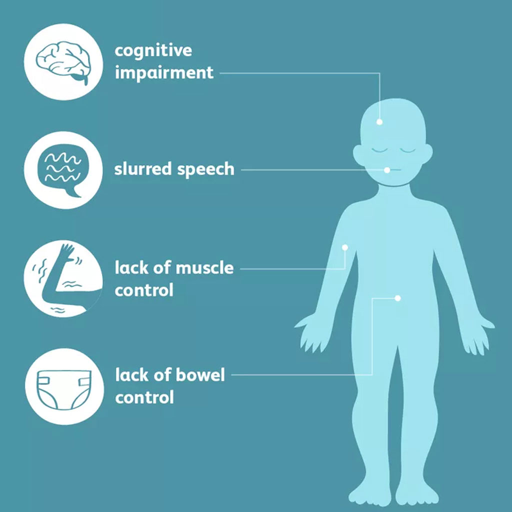 Cerebral Palsy