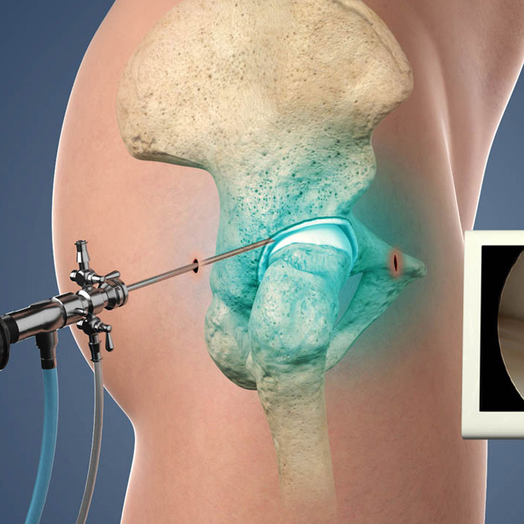 Hip Preservation Surgery