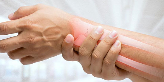 Fracture Fixation