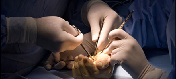 Hand Surgery