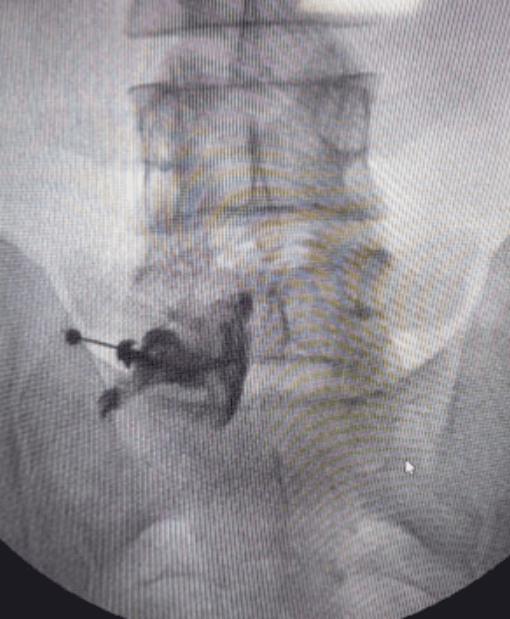 Advanced Pain Management Techniques