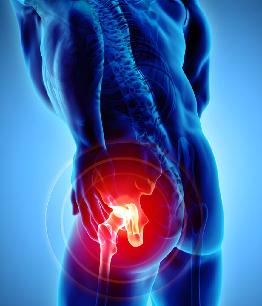 Hip Pain Treatment in Mumbai