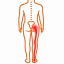 Sciatica