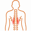 spondylitis