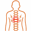 Spondylosis