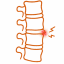 Disc Bulge