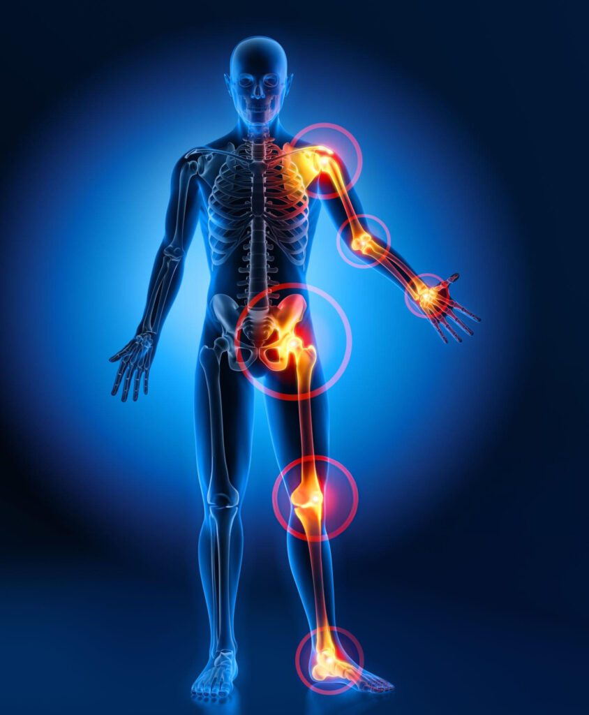 Joint Pain Treatment in Mumbai