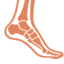 Osteomyelitis