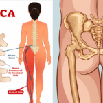 Sciatica Specialist Doctor in Kandivali