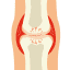 Joint Replacement Surgery