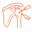 Shoulder Replacement Surgery