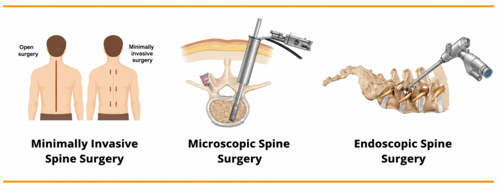 What conditions are treated by Minimally invasive spine Surgery