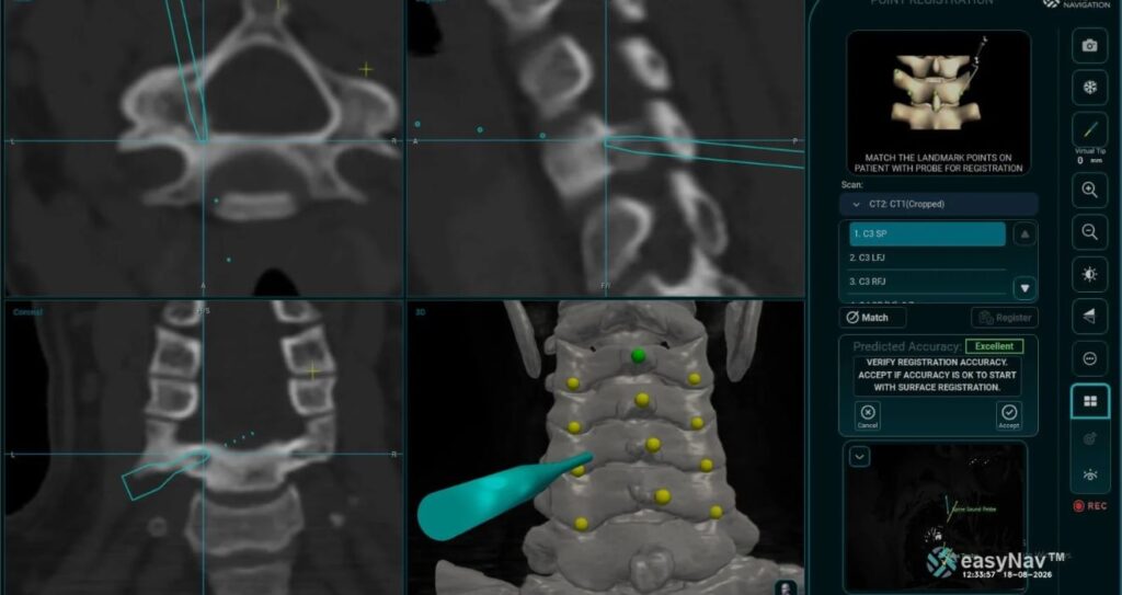 Neck pain Asymmetry