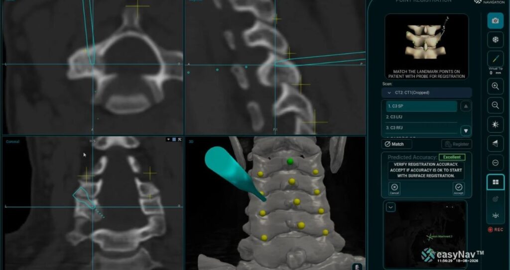 Neck & Shoulder Pain Asymmetry